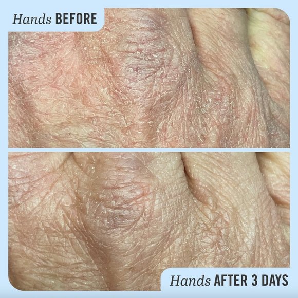 🌶4/$12 NEW First Aid Beauty Ultra Repair Cream Intense Hydration for Dry Skin - Picture 5 of 5